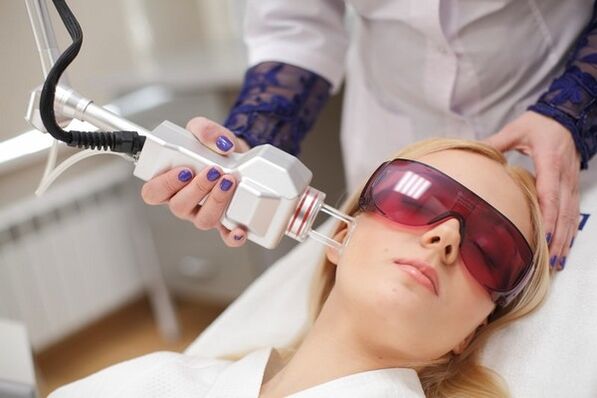 Laser Rejuven vum Gesiicht